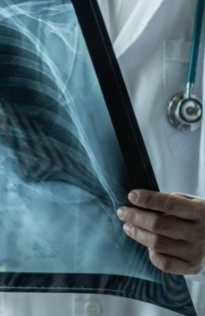 Medico che controlla lastra polmonare