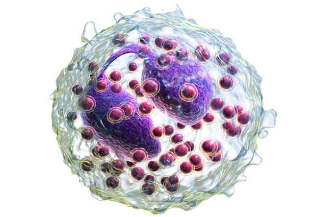 Immagine asma grave eosinofilico