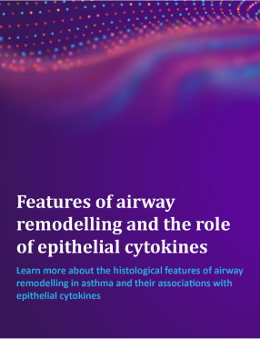 Copertina Imaging of airway remodelling