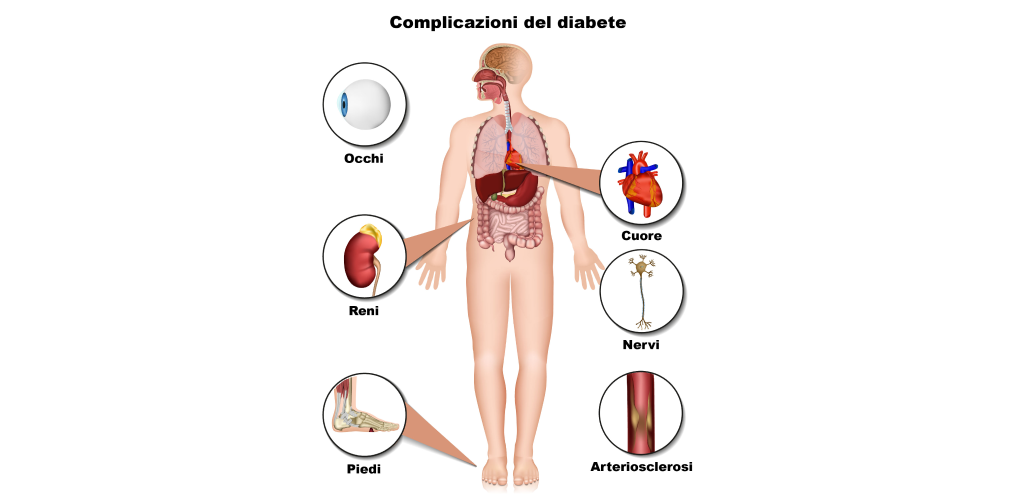 Rischiotumoreovarico