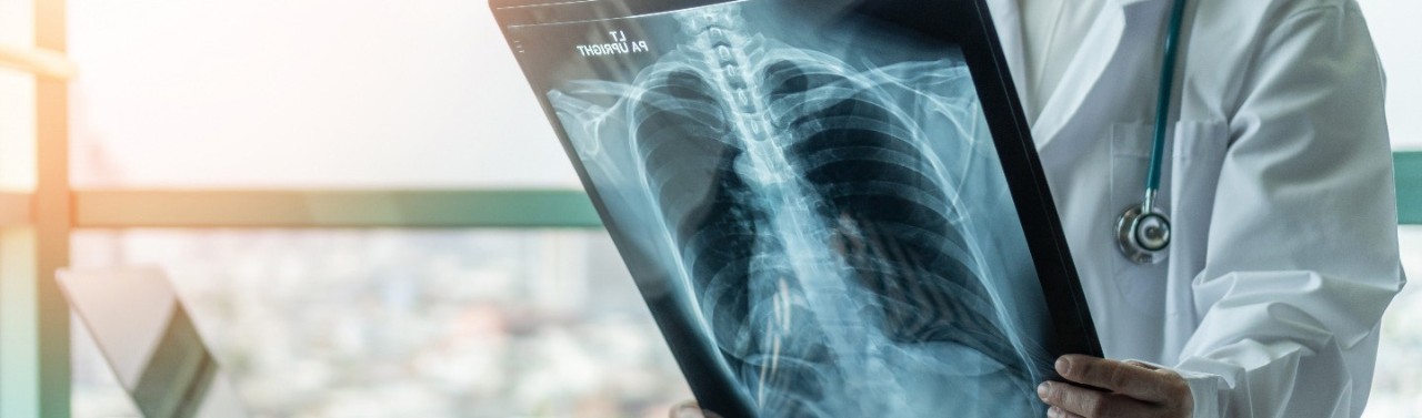 Medico che controlla lastra polmonare