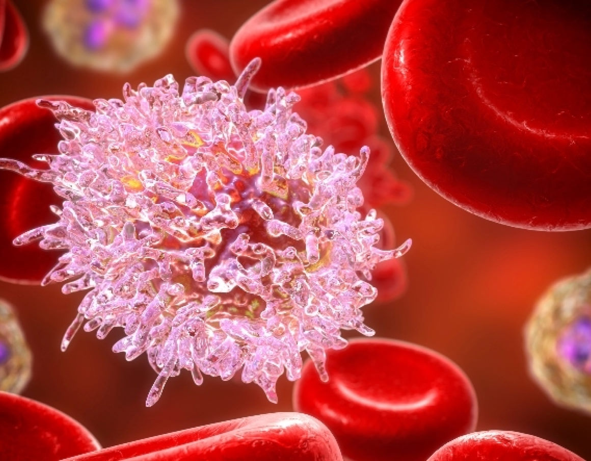 Immagine leucemia nel sangue