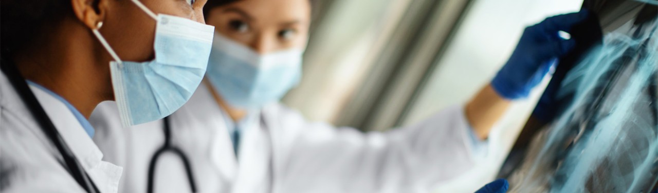 Due medici che analizzano lastra dei polmoni